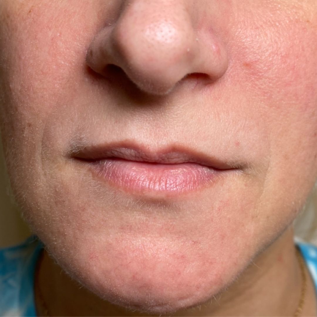 Before image