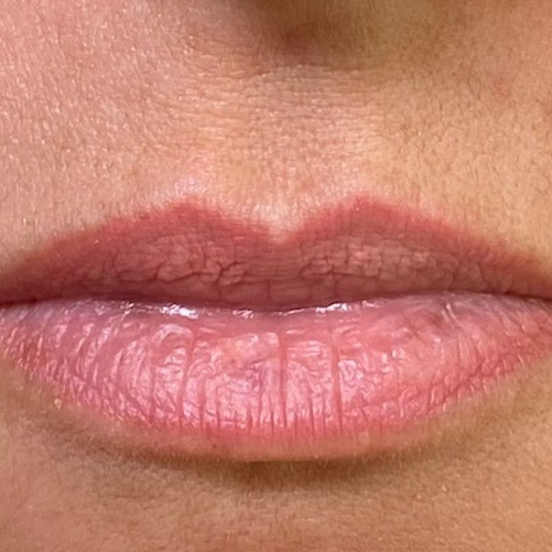 Before image